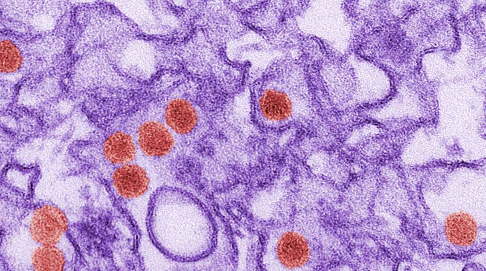 zika-virus.jpg